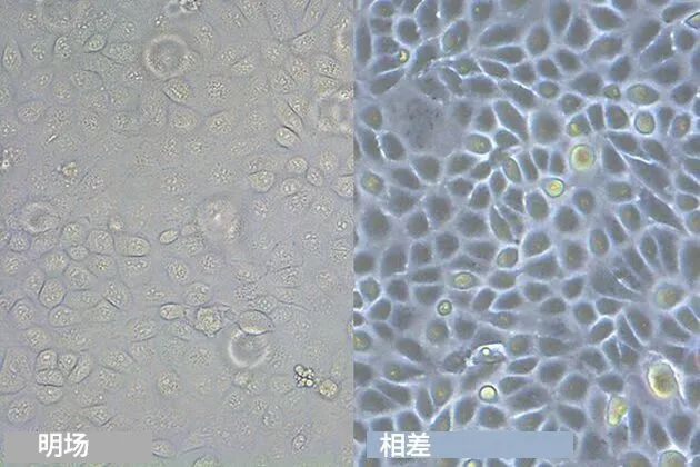 較狗腎臟細(xì)胞在明場(chǎng)照明和相差圖像中的顯示效果